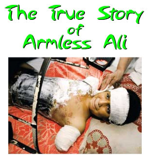 The True Story of Armless Ali